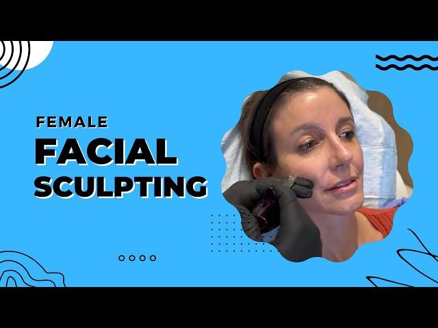 FEMALE FACIAL SCULPTING WITH THE NEW RHA | Dr. Jason Emer