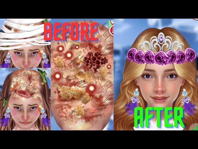 ASMR (No BGM) Removing Head Lice | Scalp Treatment Animation #satisfyingasmr #asmr #viral #trending