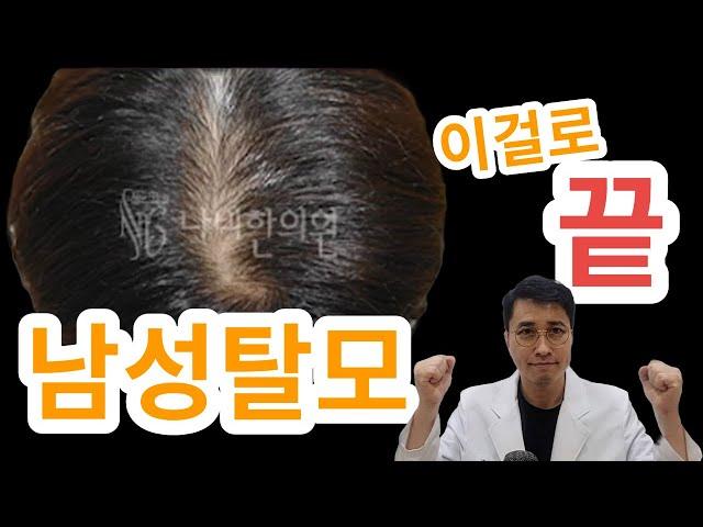 남성탈모 병원을 찾고 계신가요? 여기에서  남성탈모의 원인과 증상, 치료 방법을 알아보세요.  #남성탈모