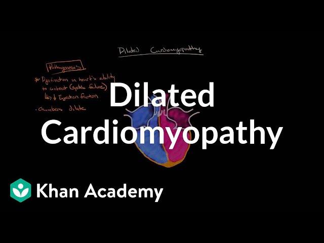 Dilated cardiomyopathy: Pathophysiology and diagnosis | NCLEX-RN | Khan Academy