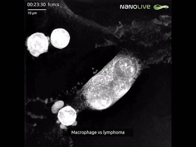 Macrophage vs lymphoma