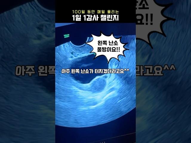 감사일기 50일차 #인공수정 #난임브이로그 #물혹 #자궁내막증 #난임부부 #임신준비 #감사일기