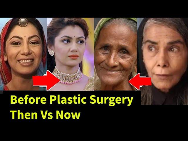 Exposed!! Popular Zeeworld Actress  Real Life  Plastic Surgery Looks.