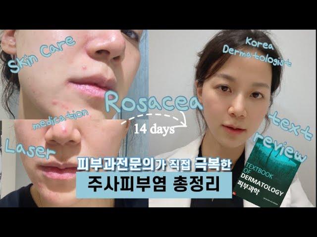 That we thought was acne or rednessEverything about rosaceaㅣDermatologistㅣSkincare&Treatment