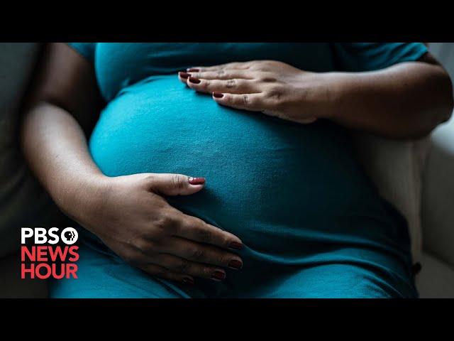 American Black women face disproportionately high rates of maternal mortality