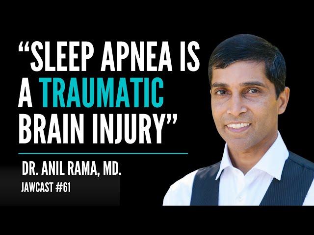 Sleep Apnea Diagnosis and Treatment - Dr. Anil Rama, MD | JawCast #61