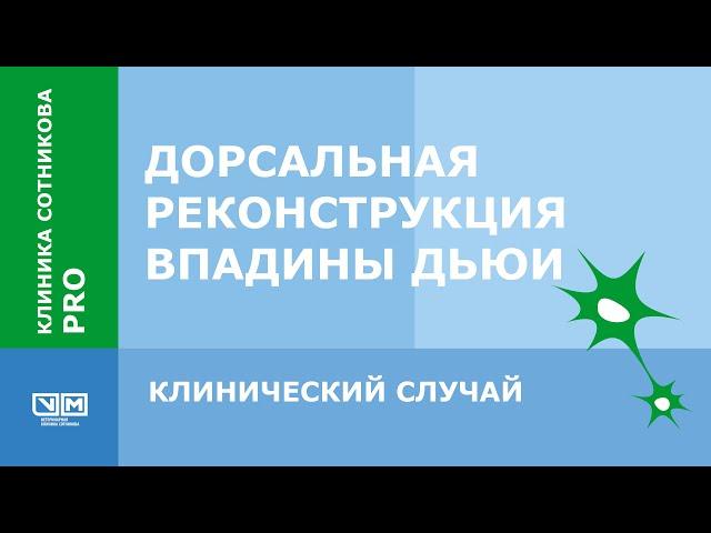 Дорсальная реконструкция впадины Дьюи. Клинический случай