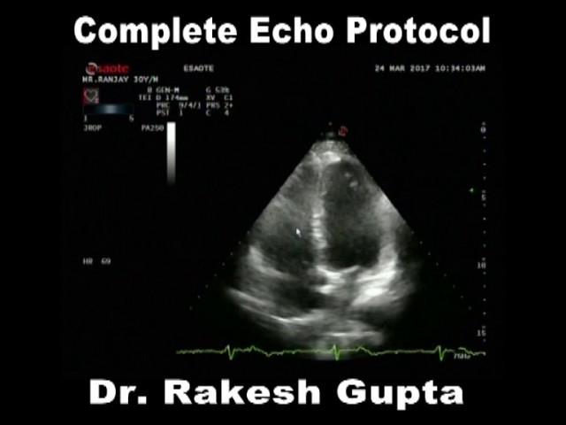 A  complete echo study Dr Rakesh Gupta