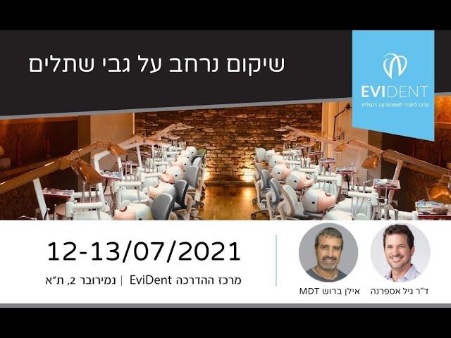 שיקום נרחב על גבי שתלים - קורס מעשי