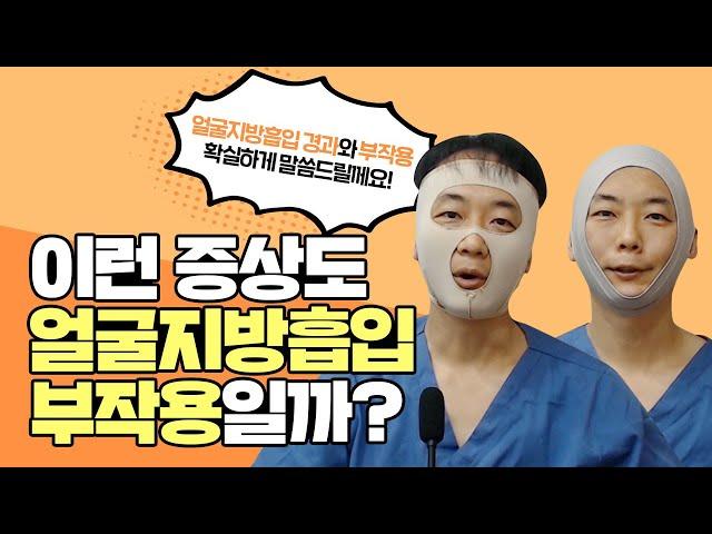 얼굴지흡 후 불안한 모든분들 필수시청 얼굴지방흡입 , 달걀수술 경과와 자가 관리법!