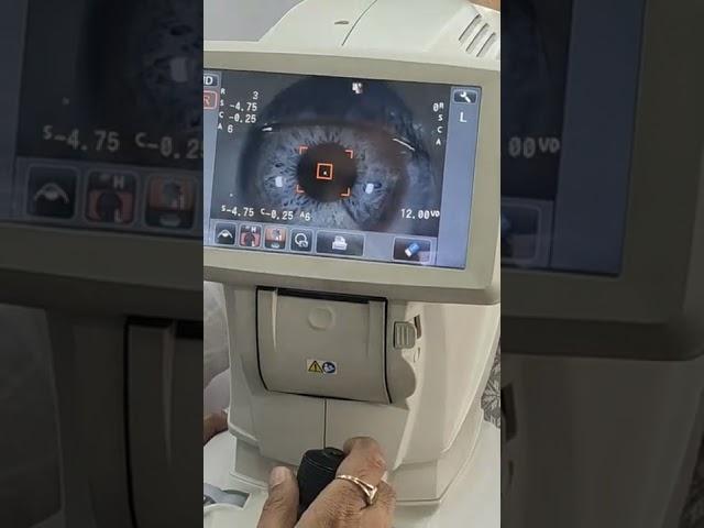 IRIS eye through magnifying machine #eyes #science #big #magnified #doctor #iris #technology