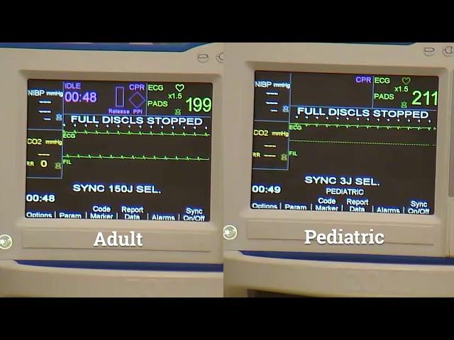 R Series Plus:  Synchronized Cardioversion