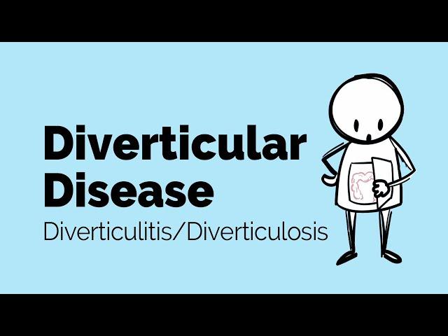 Diverticular Disease | Diverticulitis | Gastrointestinal Society