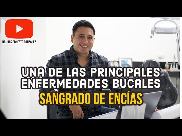 Una de las principales enfermedades bucales, Sangrado de las encías