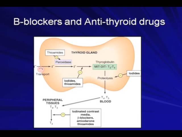 Dr. Gianoukakis -  Anti-Thyroid Drugs for Hyperthyroidism / How I Treat Hypothyroidism