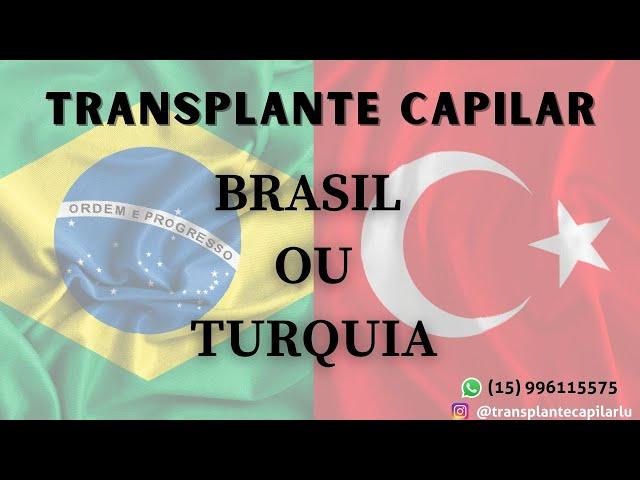 Transplante cabelo Brasil ou Turquia ? Não faça seu transplante de cabelo antes de ver este video !