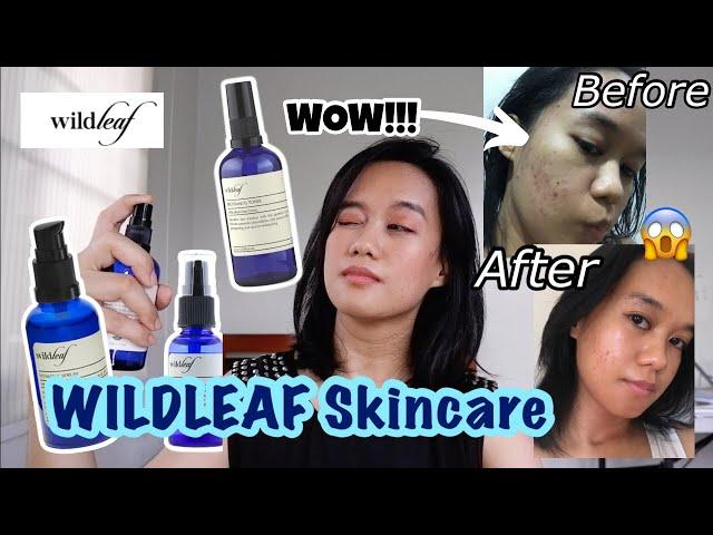 IT WORKS! ONE-MONTH IMPROVEMENT // Wildleaf Skincare Review - For Oily Sensitive Acne Prone Skin