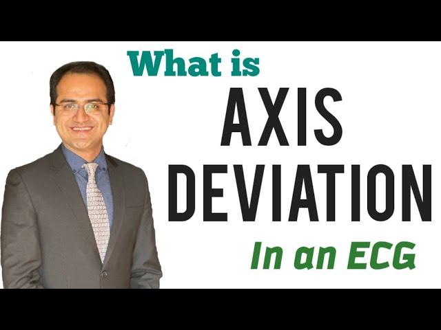 Axis Deviation in ECG Made Easy, Causes, How to determine Axis in ECG Explained, ECG Lecture USMLE