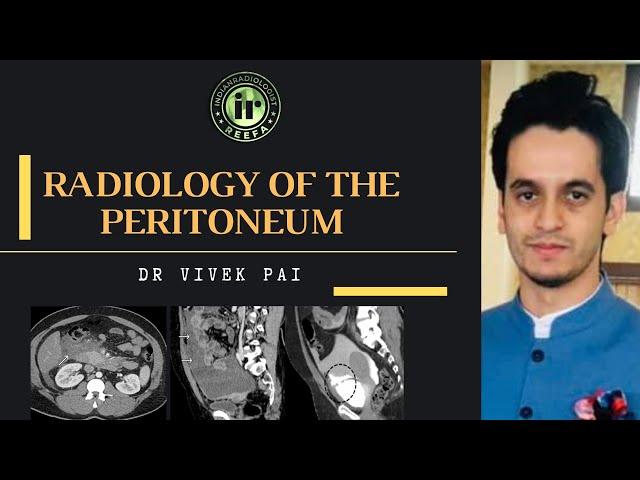 RADIOLOGY OF THE PERITONEUM | VIVEK PAI | PERITONEAL SPACES | ABDOMINAL CT | PERITONEAL METS