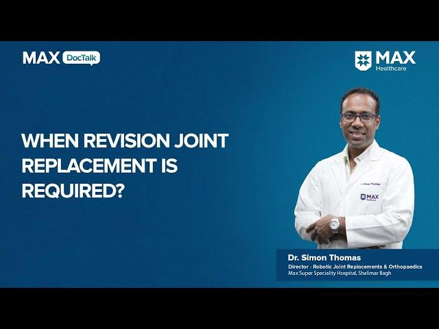 When Is Revision Joint Replacement Needed? | Dr. Simon Thomas | Max Hospital, Shalimar Bagh