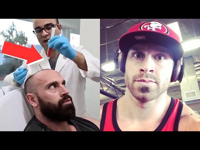 THE UGLY TRUTH Of Mens Most Hidden Insecurity - Bradley Martyn Case Study