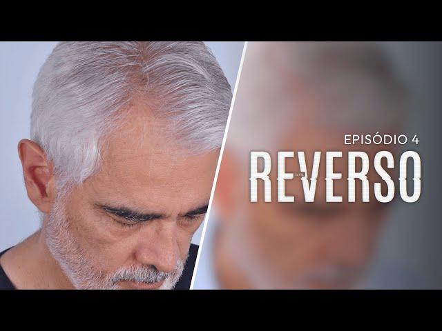 Revelando o ANTES E DEPOIS do transplante capilar | Reverso EP. 4