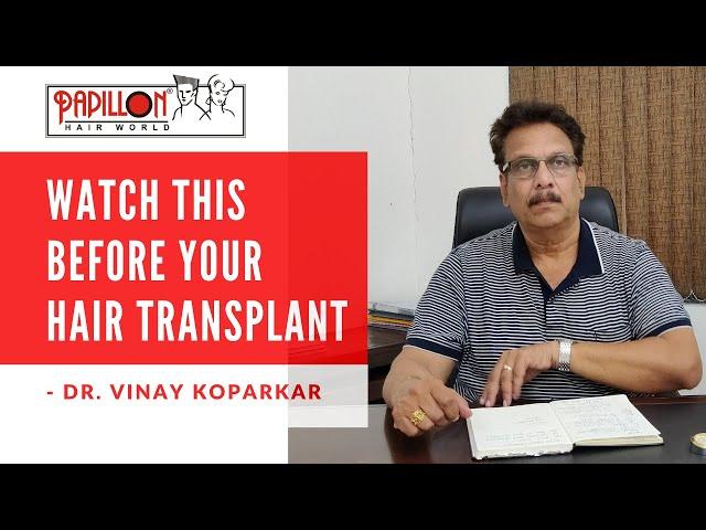 WATCH THIS before YOUR Hair Transplant | Hair Transplant Risks