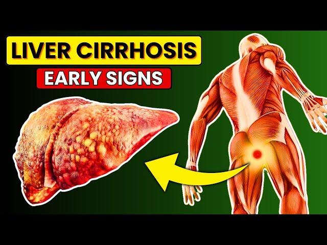 Liver Damage! 12 Early Signs & Symptoms of LIVER CIRRHOSIS | Heal Now