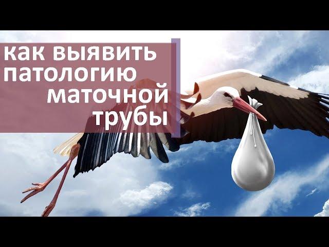 Проходимость маточных труб.  Как делают проверку проходимости маточных труб. Моситалмед