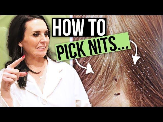 How to Remove Head Lice Eggs - Nit and Lice Picking