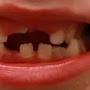 @krockedteeth