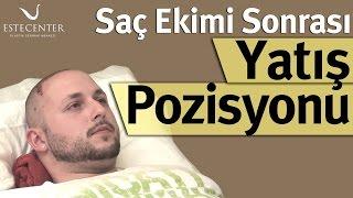 Saç Ekimi Sonrası Yatış Pozisyonu Nasıl Olmalıdır?