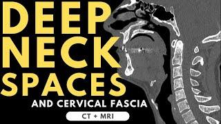 Deep neck spaces and deep cervical fascia anatomy | Radiology anatomy part 1 prep | CT and MRI