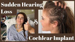 Sudden Hearing Loss, Deafness, Cochlear Implant Journey