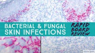 Infectious Dermpath (bacterial & fungal): Board Review for Dermatology & Pathology (20 cases)