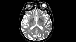 Atlas of normal structure and blood flow