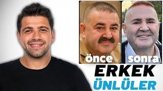 ESTETİK CERRAH, ERKEKLERİN ESTETİK OPERASYONLARINI AÇIKLIYOR!