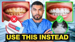 How To Fix Your Teeth (Use At Home Products)