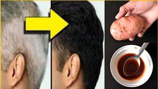 From white hair to black hair naturally in just 4 minutes permanently!  100% works!