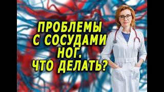 Проблемы с сосудами ног. Что делать? Кардиолог. Анна Кореневич