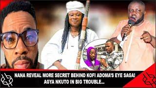  NANA BLACK POWER GIVES MORE REVELATOIN BEHIND KOFI ADOMA’S EYE SAGA! AGYA NKUTO IN BIG TROUBLE...