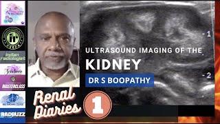 ULTRASOUND IMAGING OF THE KIDNEYS || DR S BOOPATHY || ANATOMY, VARIATIONS, TIPS AND TRICKS ON USG