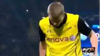 Sven Bender With Broken Nose Napoli vs dortmund