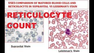 Reticulocyte Count || Supravital stain, Comparison of Reticulocyte and Mature Red Blood Cell (RBC).