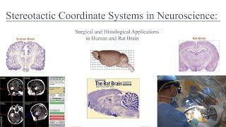 Stereotactic Coordinate Systems in Neuroscience and Medicine: Applications in Rat and Human Brain