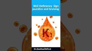 jaundice and bruising