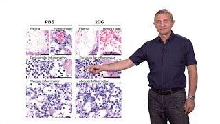 Ruslan Medzhitov (Yale / HHMI) 2: Inflammation and Disease Tolerance: Surviving Acute Illness