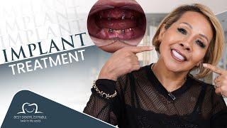 "Gabriel's Life-Changing Smile Transformation at Best Dental | Dental Implant Success Story"