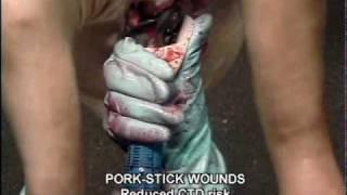 PorkStickWounds.wmv