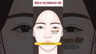 졸린 눈 VS 안검하수의 기준 #shorts